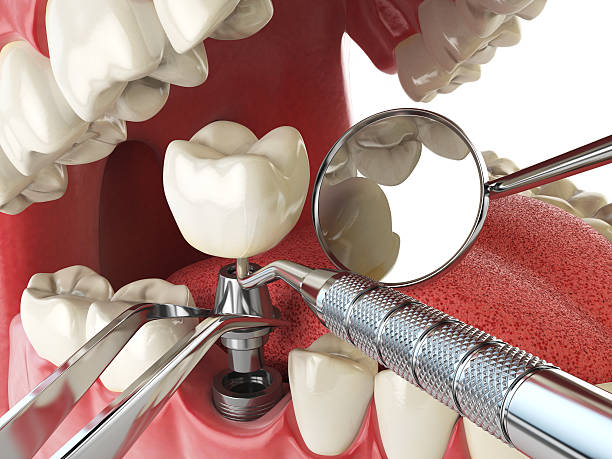 Best 24-Hour Emergency Dental Care in Chisholm, ME
